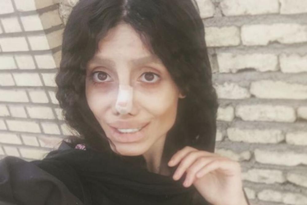 ISPRAVKA Devojka iz Irana se nije operisala da bi ličila na Anđelinu, koristila fotošop i šminku
