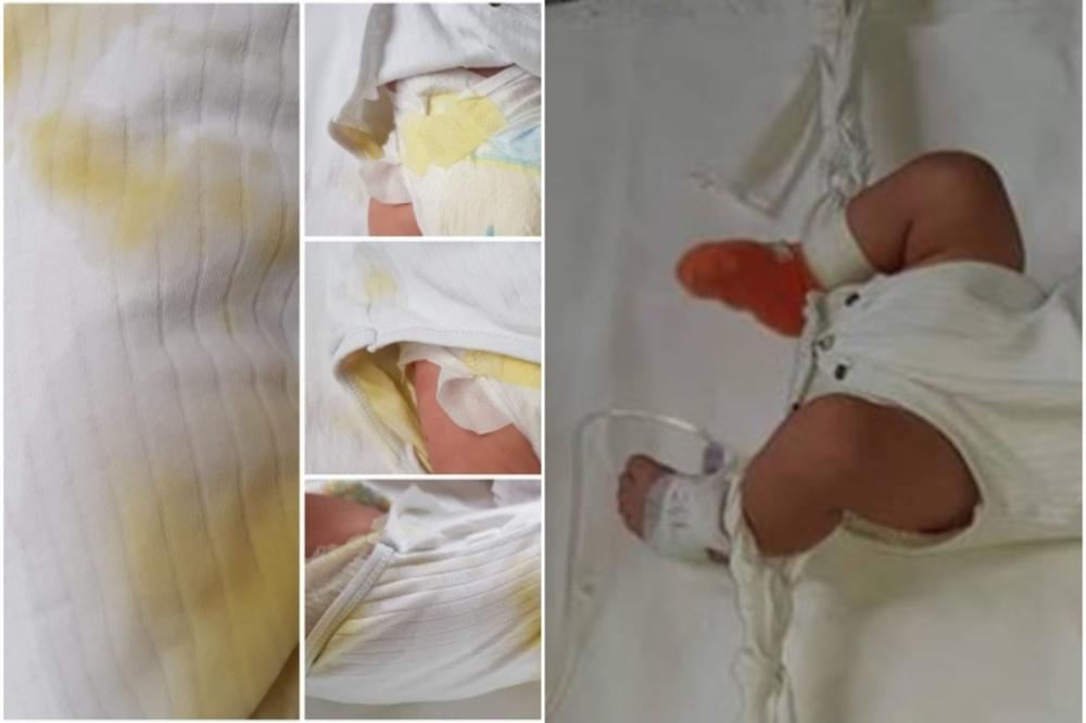 SLIKE IZ ZAGREBAČKE BOLNICE ZGROZILE JAVNOST: Zatekla bebe od 5 meseci u ranama, bile vezane za krevetiće (FOTO)