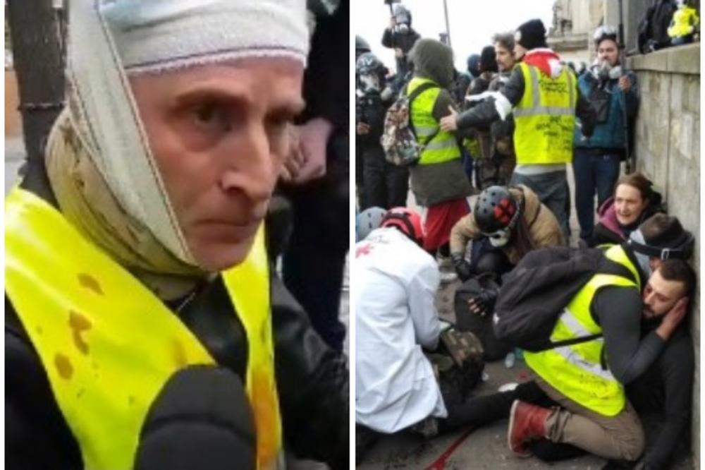 JEZIVE SCENE SA PARISKIH ULICA: Granata otkinula ruku demonstrantu Žutih prsluka! Policija sve brutalnija! (UZNEMIRUJUĆI VIDEO)