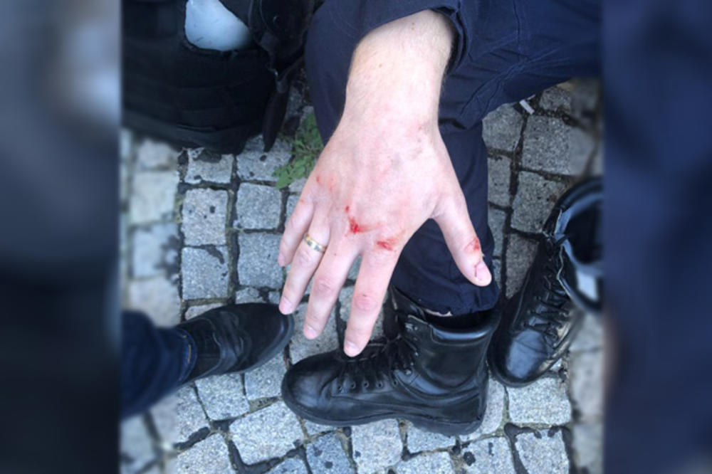 KURIR EKSKLUZIVNO! NASILNICI SUZAVCEM I NOŽEM NAPALI POLICAJCE: Ovo je jedan od povređenih policajaca! (FOTO)