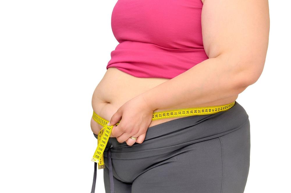 debela žena, gojaznost