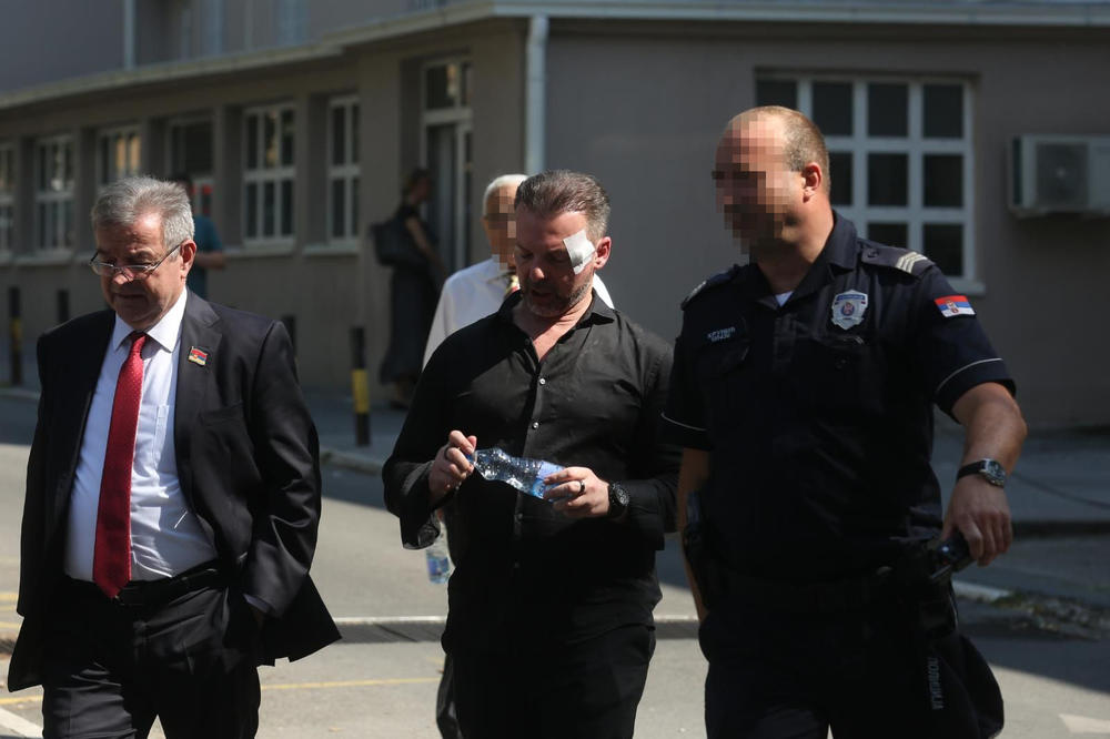 DRAGOMIR KARIĆ DOŠAO PO SINA! Pogledajte kako su izveli Simona iz Urgentnog i to uz pratnju policije! (FOTO)