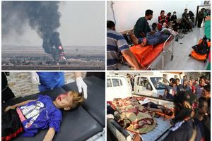 KURDI OBJAVILI KRVAVI BILANS TURSKE OFANZIVE: Turska vojska ubila 200 civila i 18 dece, više od 650 ranjeno!