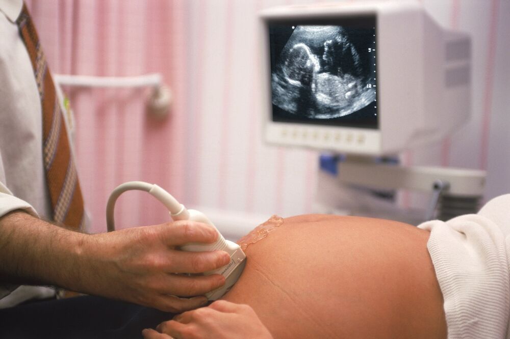 0221385510, ultrazvuk, trudnoća, trudnica