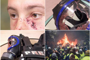 NOVINARU GRANATA EKSPLODIRALA U LICE: Francuska policija RATNIM ORUŽJEM ide na Žute prsluke! (UZNEMIRUJUĆE)