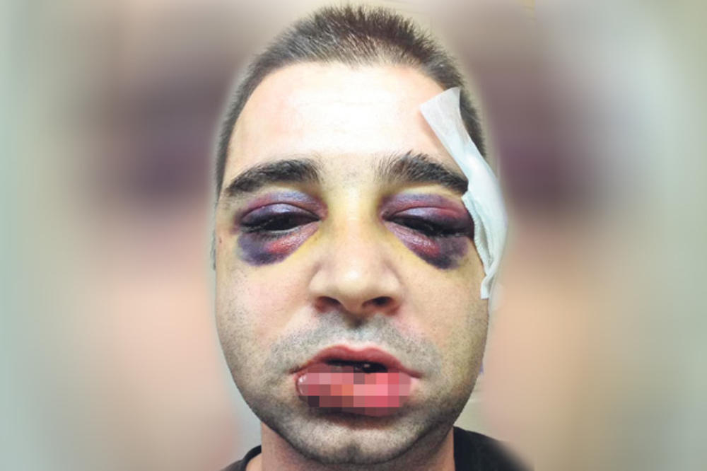 STRAVIČAN NAPAD U CENTRU NOVOG SADA: Mladić (26) brutalno UNAKAŽEN ispred noćnog kluba!