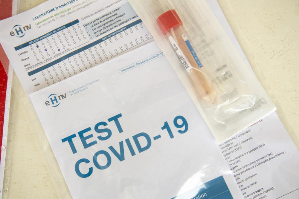 koronavirus, pandemija, test, covid-19