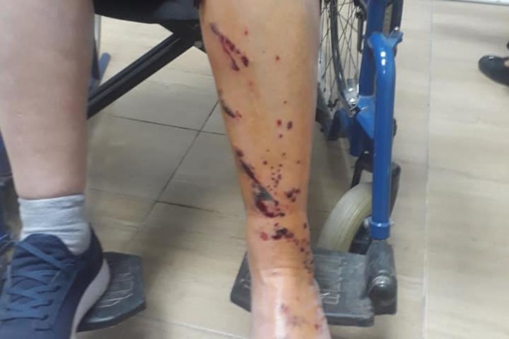 LAŽNA SLIKA SA PROTESTA U CRNOJ GORI: Nema dokaza da je žena pretučena u Nikšiću (FOTO)