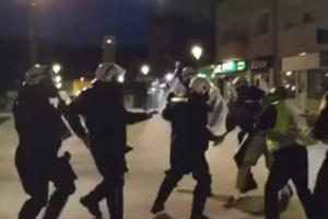 MILOVA POLICIJA ZVERSKI TUKLA MLADIĆA: Pendrecima, rukama i nogama unakazili čoveka! (VIDEO)