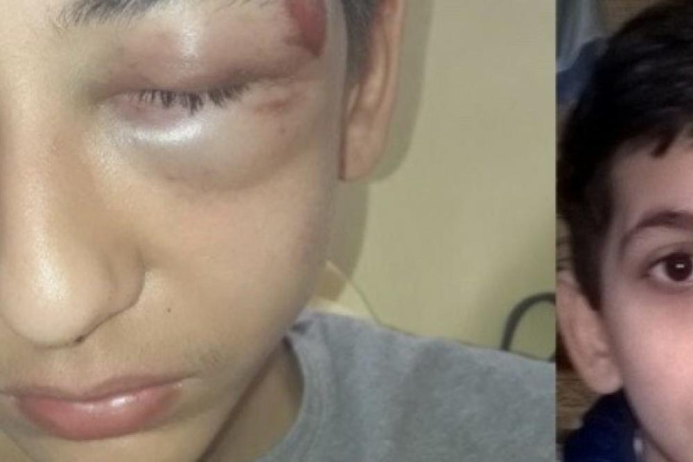 OVO JE DEČAK IZ SRBIJE KOG SU PREBILI FRANCUSKI POLICAJCI: Oborili ga i šutirali u glavu, izbili mu zube, povredili oko