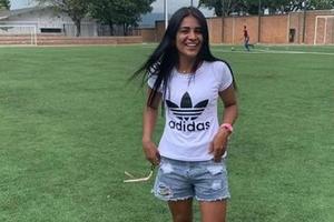 OKRUTNA IGRA SUDBINE: Prelepa kolumbijska fudbalerka doživela BIZARNU NESREĆU posle koje joj je AMPUTIRANA NOGA (FOTO)