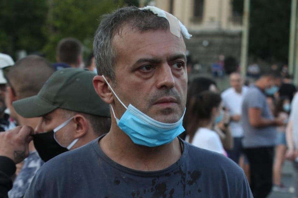 PSG PODNOSI KRIVIČNU: Prijava protiv NN lica zbog napada na Sergeja Trifunovića
