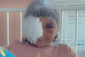 KAO DA JE UJEO LAV, A NE PAS! Devojčicu koju je unakazio staford u Aranđelovcu, čeka još jedna operacija! UZNEMIRUIJUĆE