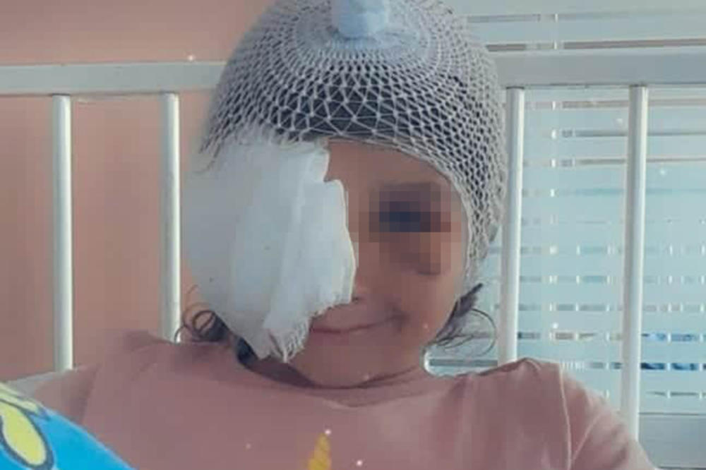 KAO DA JE UJEO LAV, A NE PAS! Devojčicu koju je unakazio staford u Aranđelovcu, čeka još jedna operacija! UZNEMIRUIJUĆE