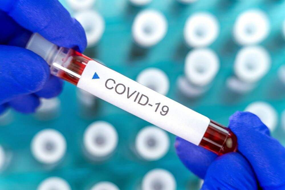 kovid-19, koronavirus, test
