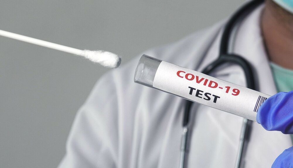 0557333835, koronavirus, korona virus, PCR test, testiranje