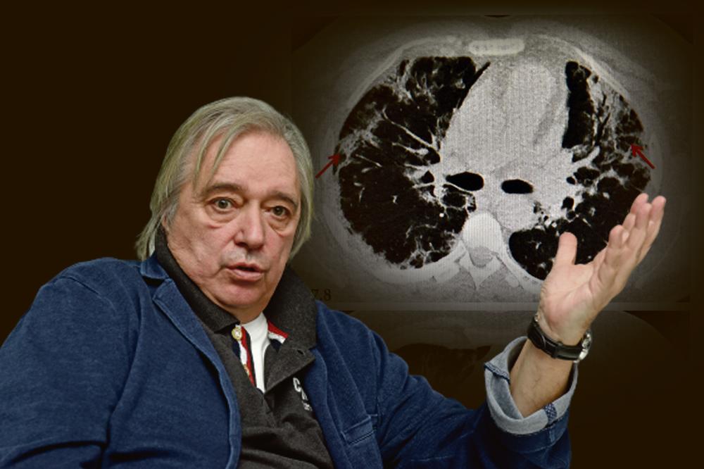 KORONA RAZORI PLUĆA TAKO DA OD NJIH NE OSTANE GOTOVO NIŠTA: Dr Lalošević otkriva šta opaki virus radi organizmu!