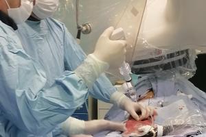 NOVA METODA U INSTITUTU "DEDINJE": Talasima otčepljuju arterije zabetonirane kalcijumom