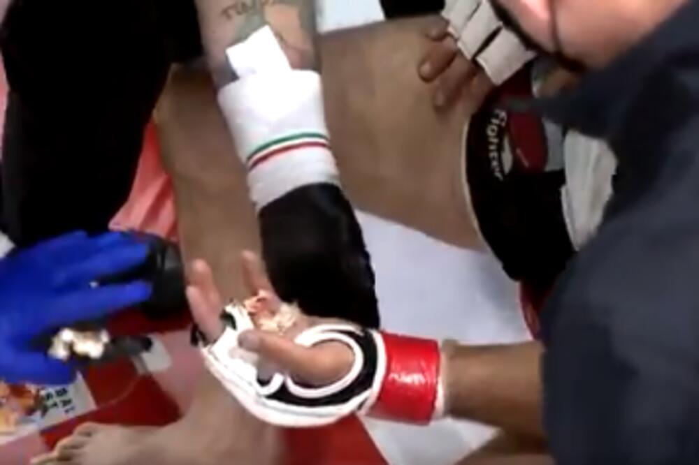 ZASTRAŠUJUĆA SCENA: MMA borac ostao bez PRSTA tokom borbe! UZNEMIRUJUĆI VIDEO