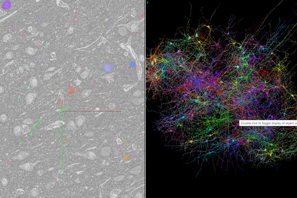GUGLOVA MAPA MOZGA: Kompanija napravila najdetaljniju mapu dela ljudskog mozga, otkrili nešto neverovatno!
