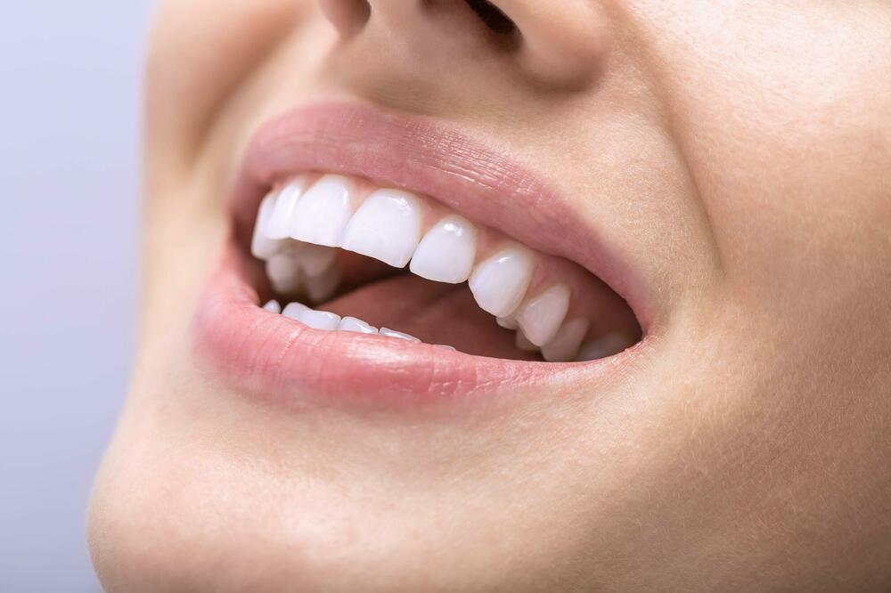VRATITE OSMEH NA LICE: Koristite OVO i ponovo ćete imati blistavo bele zube!
