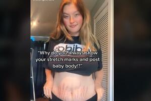 MLADU MAMU (18) VREĐAJU ZBOG STRIJA! Govore joj da izgledom posle porođaja ODVRAĆA žene od TRUDNOĆE: Užasno izgledaš, FUJ! (VIDEO)