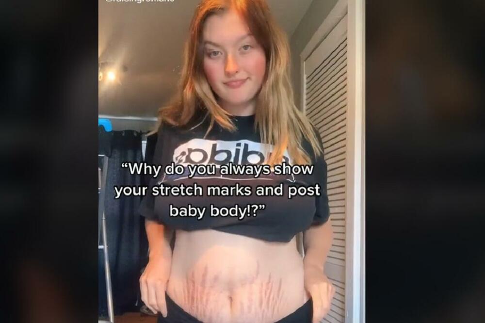 MLADU MAMU (18) VREĐAJU ZBOG STRIJA! Govore joj da izgledom posle porođaja ODVRAĆA žene od TRUDNOĆE: Užasno izgledaš, FUJ! (VIDEO)