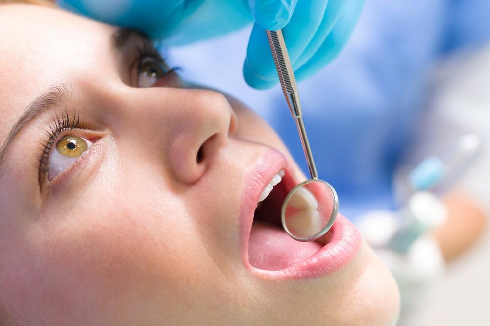 DOKTORKA STOMATOLOGIJE UPOZORAVA: Pokvaren zub može da izazove brojna ozbiljna oboljenja, a evo kako prepoznati početak INFEKCIJE