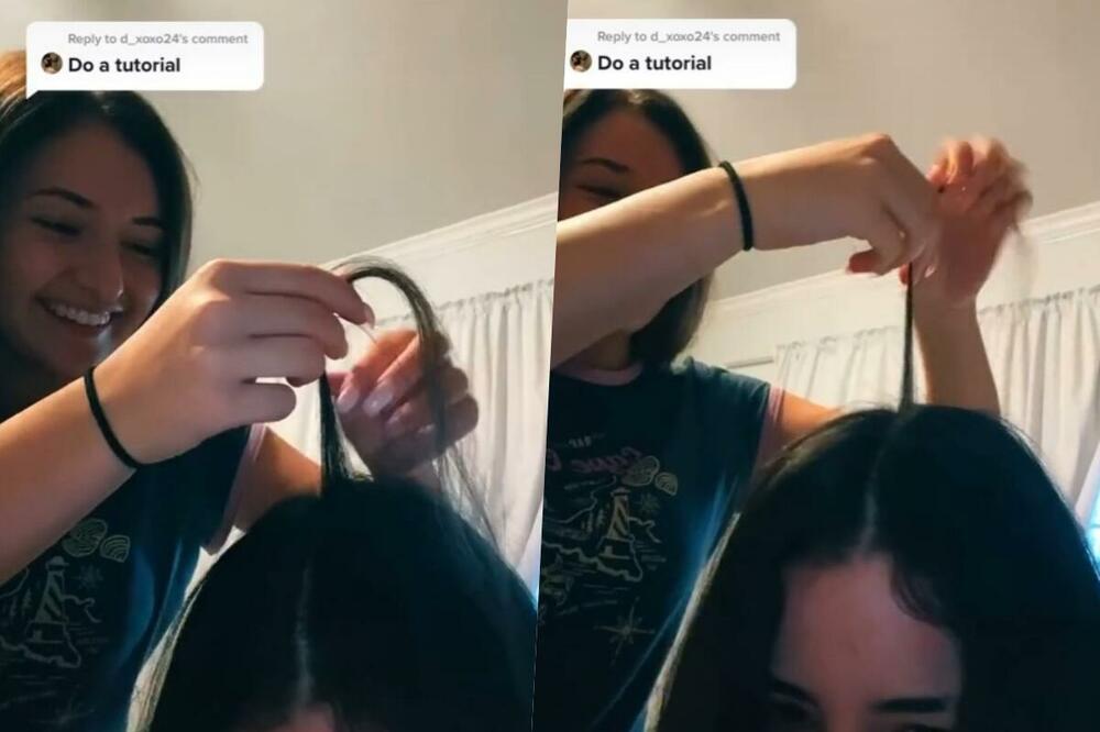 DOKTOR UPOZORAVA NA BIZARNI TIK TOK TREND: Devojke čupaju kosu, ali ne znaju koliko to može da UGROZI njihovo ZDRAVLJE! (VIDEO)