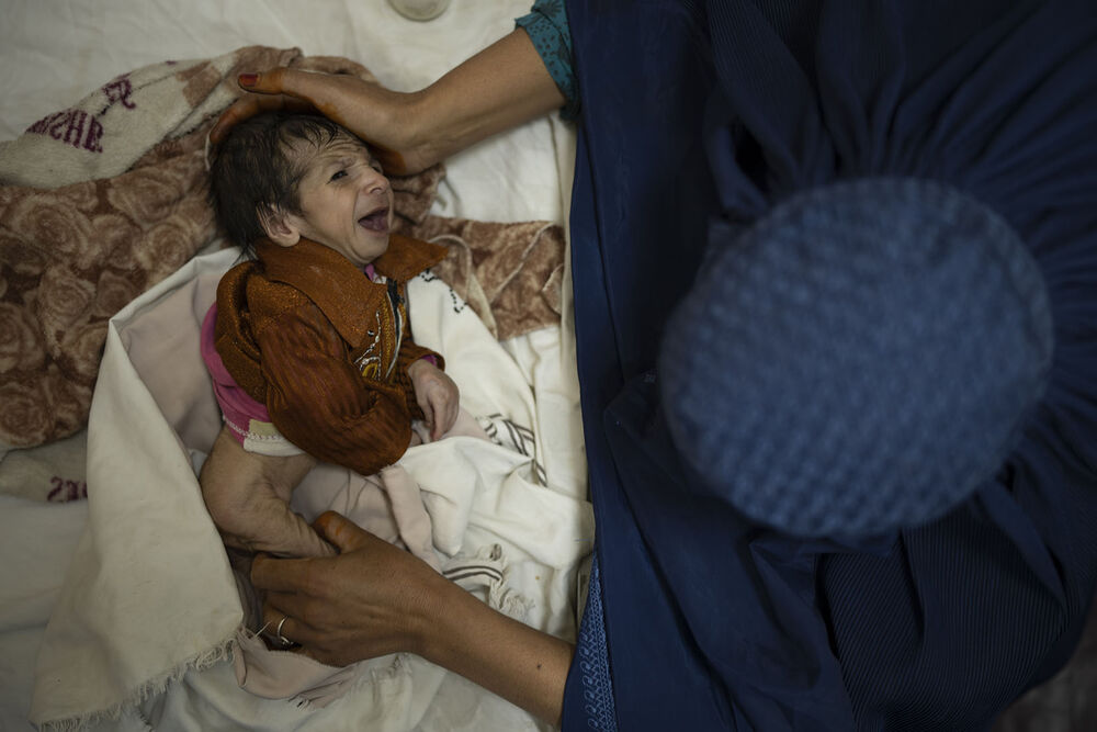 Nestašica hrane uzima danak Neuhranjena beba u Avganistanu
