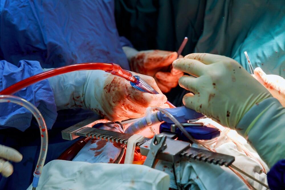 operacija srca
