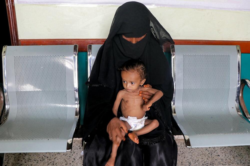 MILIONIMA LJUDI PRETI GLAD: UN zbog nedostatka sredstava smanjuju dnevne obroke u Jemenu