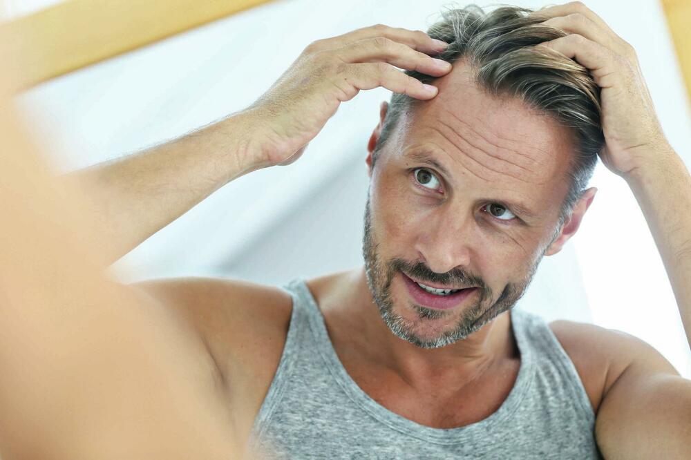 KAKO SPREČITI OPADANJE KOSE: Saveti i metode za očuvanje zdrave kose