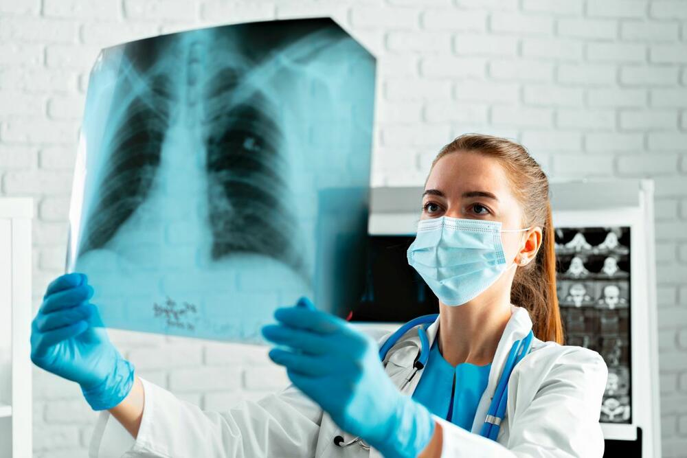 pluća, rendgen, snimanje pluća