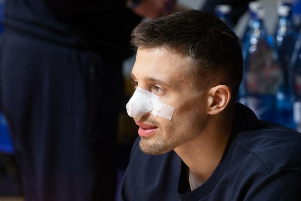 Aleksa Avramović, slomljen nos
