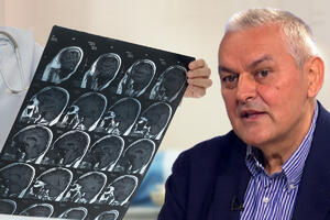 DOBRE VESTI, STIŽE SPAS! PROF. DR RAIČEVIĆ: Novim lekovima bi se od moždanog udara spasilo 14.000 ljudi