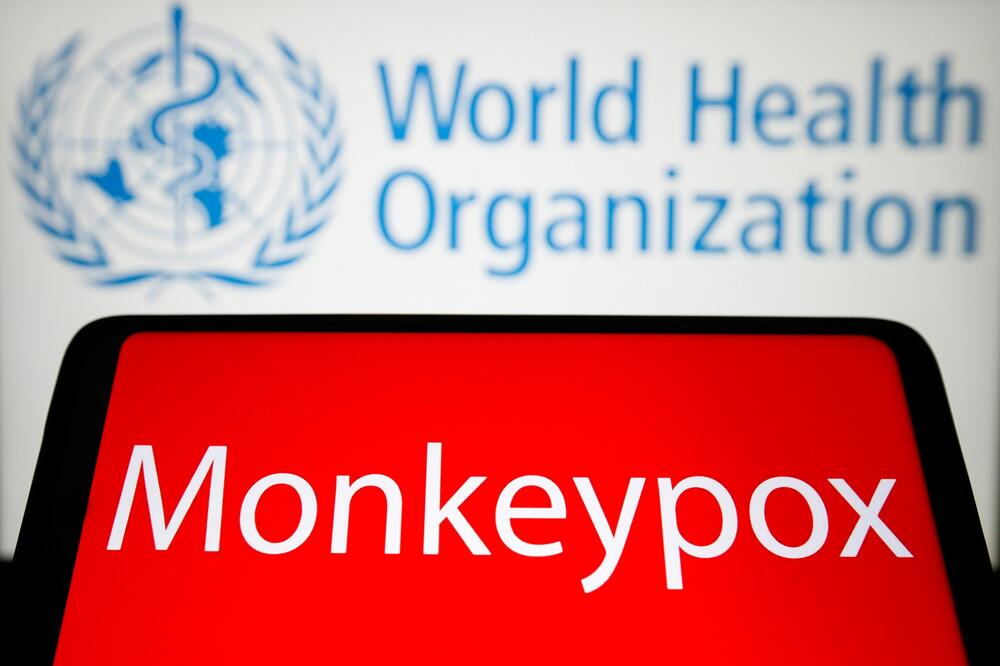NEMA RIZIKA OD PANDEMIJE? SZO potvrdila 80 slučajeva majmunskih boginja u 11 zemalja