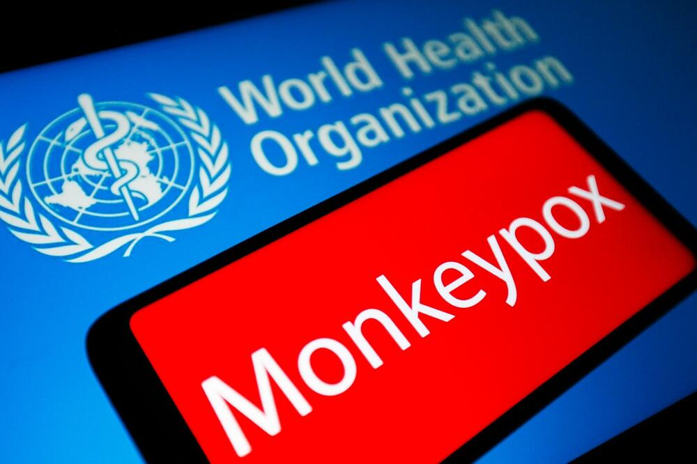 SVETSKA ZDRAVSTVENA ORGANIZACIJA UMERENO OPTIMISTIČNA: Nije verovatno da će majmunske boginje prerasti u pandemiju
