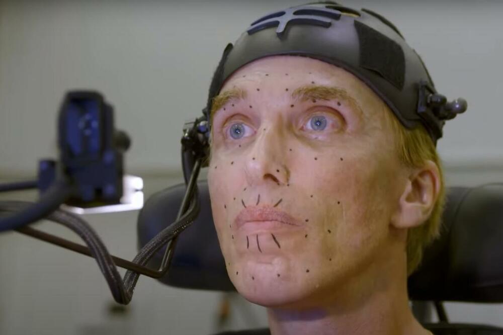 UMRO ČOVEK KIBORG: Preminuo britanski lekar sa terminalnom bolešću koji je želeo da postane živi robot VIDEO