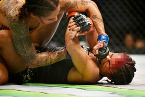 UZNEMIRUJUĆI PRIZOR! RIVALKA JOJ ODVALILA KOMAD ČELA: Surova šampionka brutalnim udarcima POCEPALA FACU najlepšoj UFC borkinji!