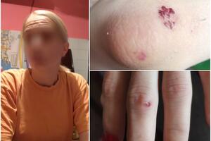 ČUPALA ME ZA KOSU, UDARALA IZ SVE SNAGE, POTPUNO VAN SEBE: Prve slike medicinske sestre iz Niša koju je napala tinejdžerka (16)