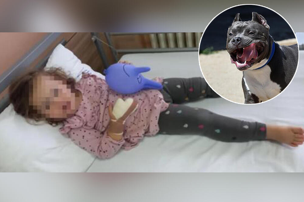 KRISTININA BORBA JOŠ TRAJE: Devojčica (2) iz Beograda kojoj je pas pojeo prst se fizički oporavlja, ali ŽIVI U STRAHU