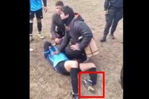 UZNEMIRUJUĆI PRIZOR! Stravičan lom noge mladog fudbalera: Gubio svest zbog nesnosnih bolova! (VIDEO)