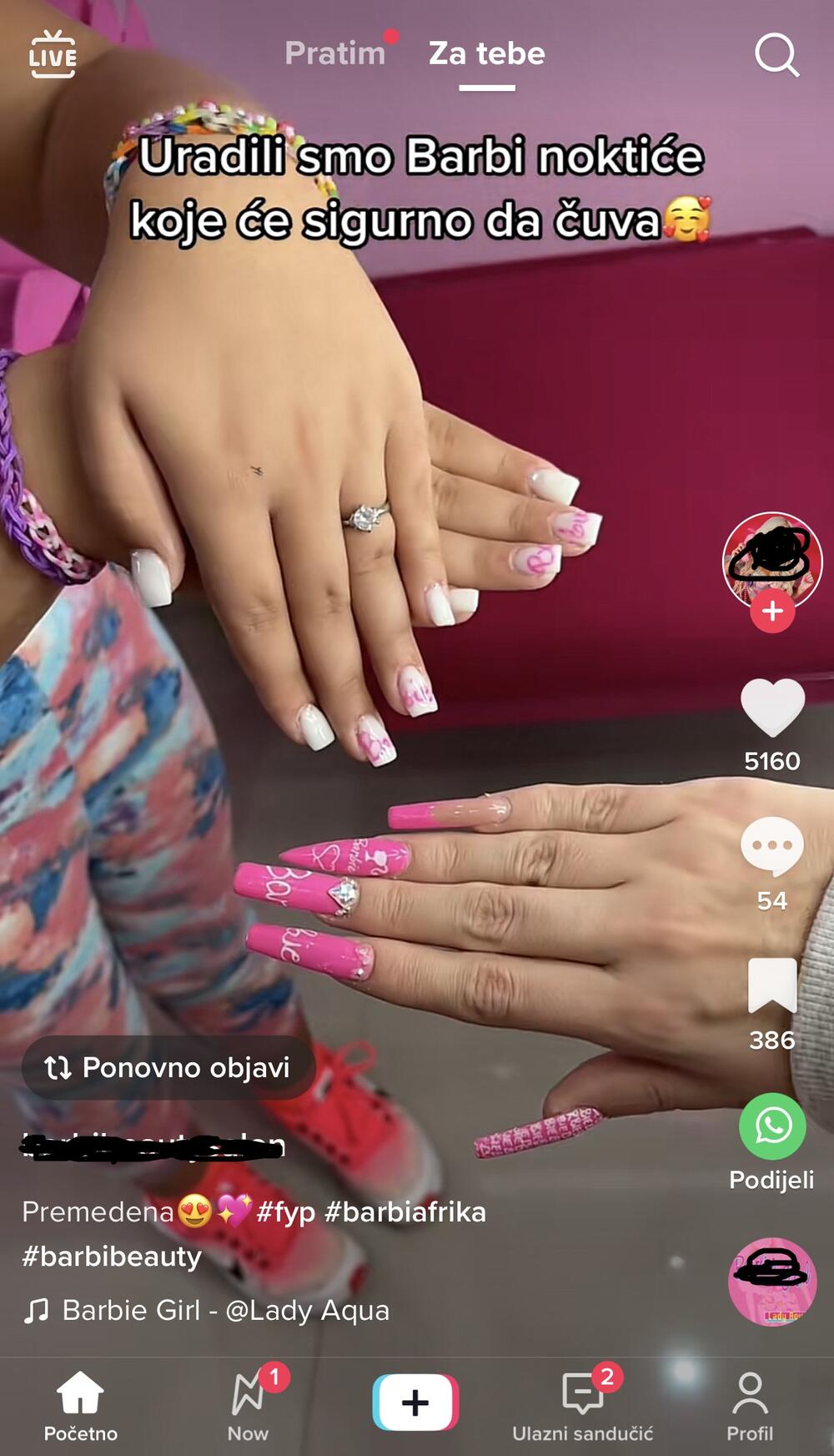 Devojčici uradili izlivanje noktiju