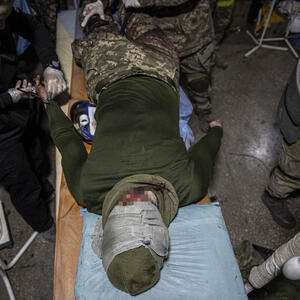 PAKAO BAHMUTA: Jezive fotografije ukrajinskih ranjenika iz bolnice posle