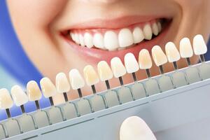 ZA BLISTAV OSMEH: Kako da izbelite zube do dočeka Nove godine?