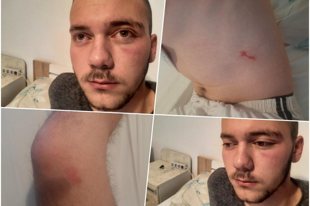 ANOTHER ATTACK AGAINST SERBS IN KOSOVO: Group of Albanians beat up youth near Klokot on his way back from Christmas liturgy!