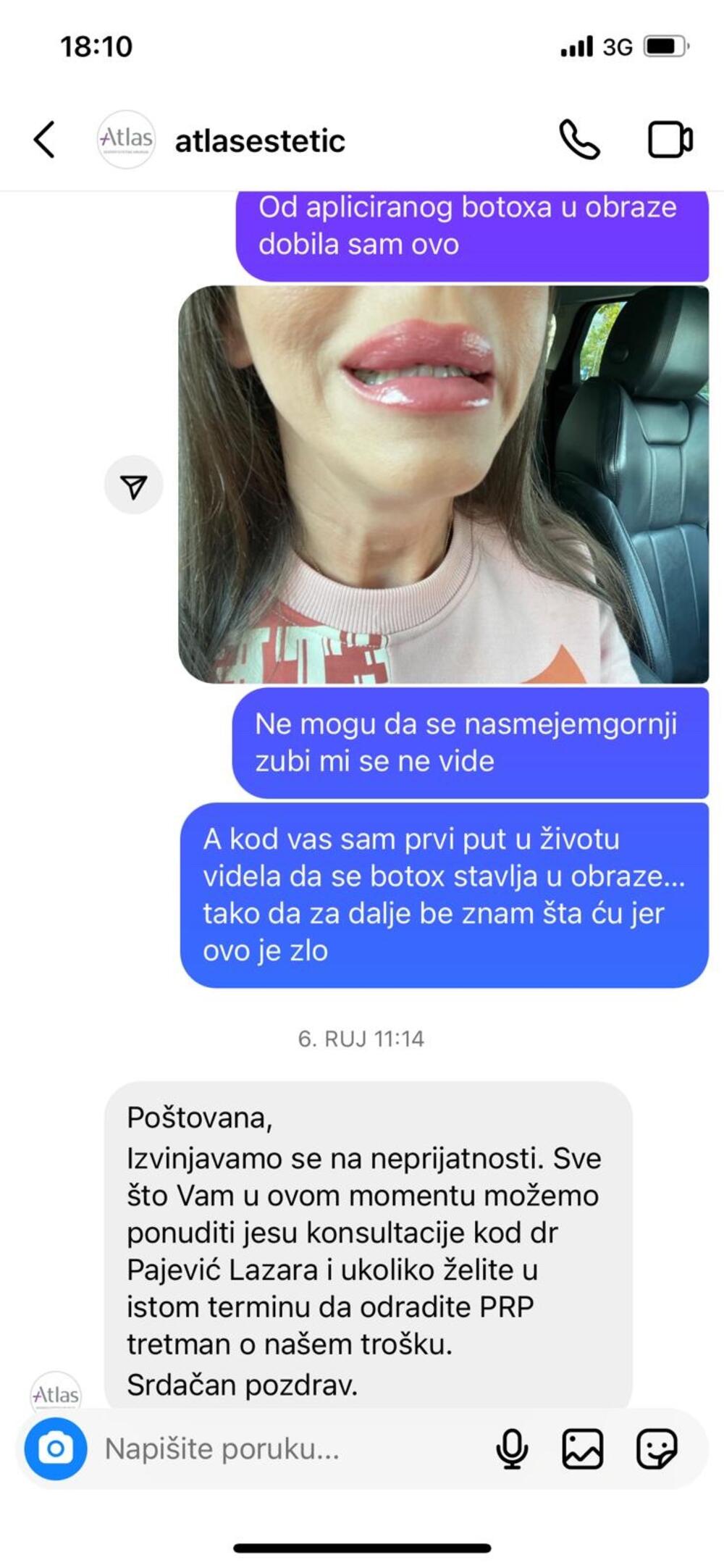 Unakažena na botoksu, Maja Božović