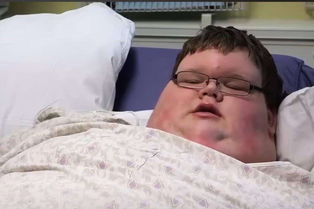 PRIČA O PATNJI NAJDEBLJEG TINEJDŽERA IKADA: Imao je 320 kilograma sa 15 godina i borio se za život, lekarima MISTERIJA (VIDEO)