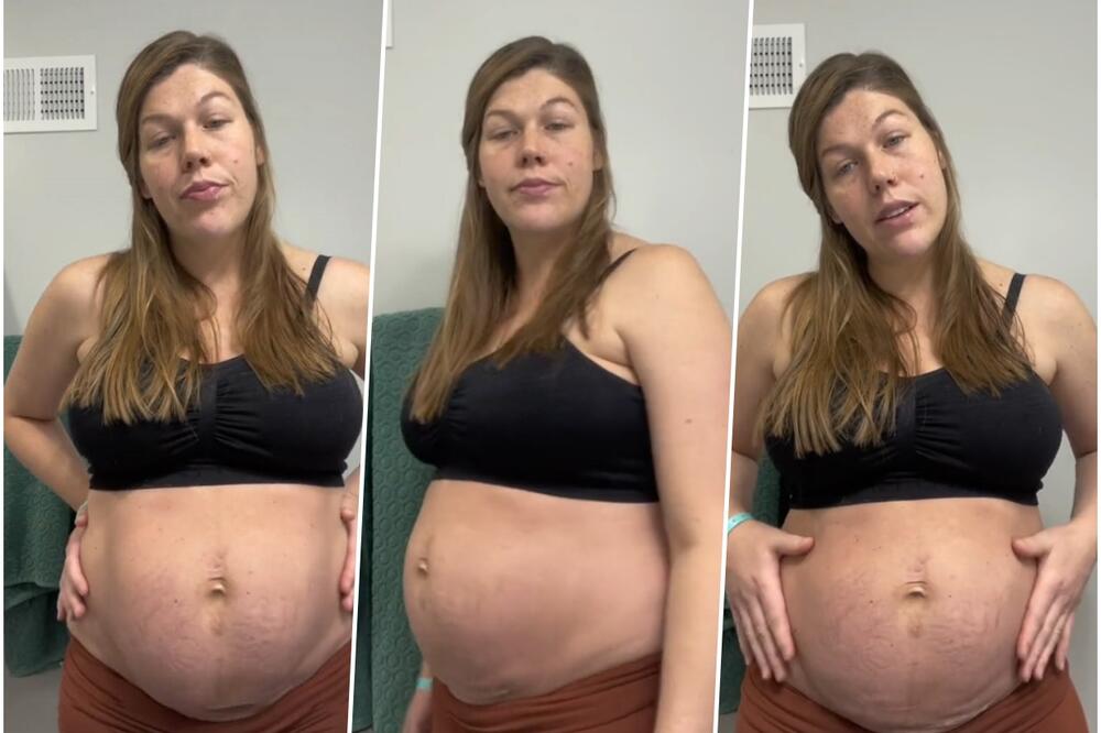 MAMA POKAZALA KAKO IZGLEDA STOMAK NAKON POROĐAJA: Rodila trojke, a posle 11 dana nije očekivala da ovo vidi u ogledalu! (VIDEO)